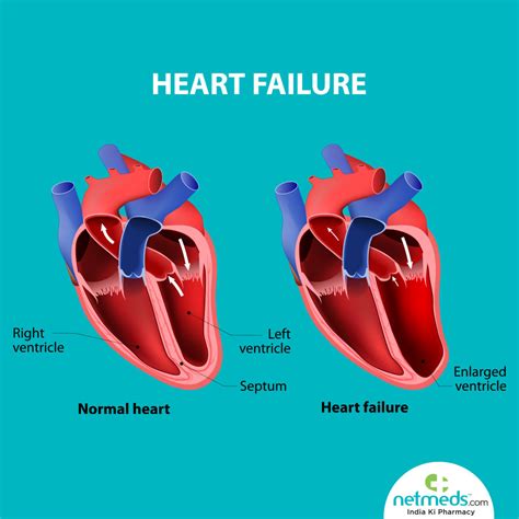 mild to moderate lv dysfunction